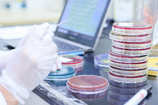 微生物学的検査